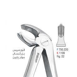 فورسپس مولر کوشافرین درمان