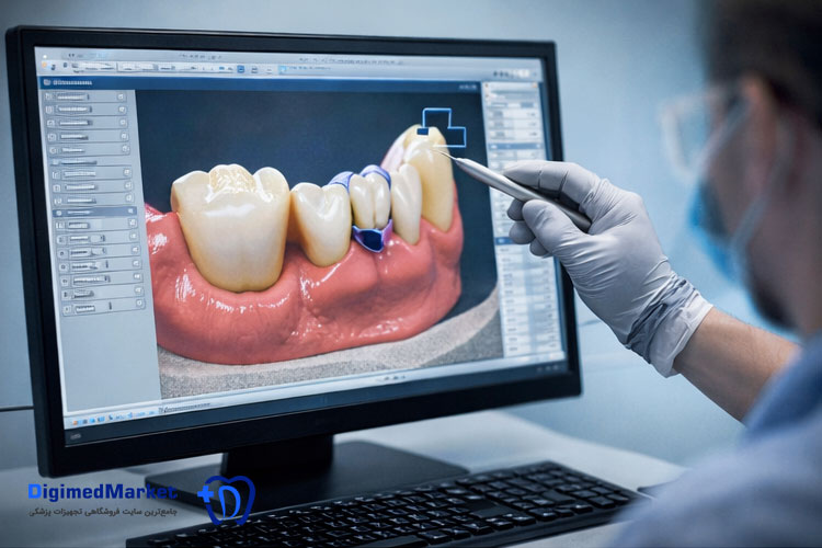 چرا فناوری CAD/CAM در دندان‌پزشکی مهم است؟